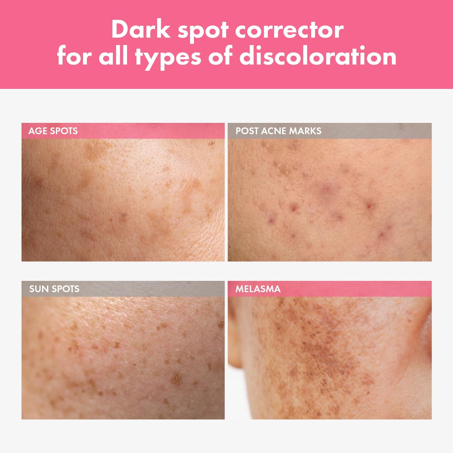 TOSOWOONG Arbutin 7% Intensive Spot Cream with 70,000ppm Arbutin, 3% Tranexamic Acid, 1% Niacinamide, Glutathione, Dark Spots - Maple Wellness Supplements