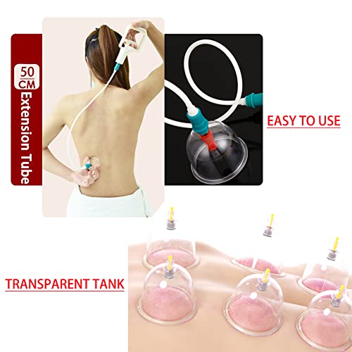MYMM 12 Cupping Cups Sets Biomagnetic Traditional Professional Chinese Therapy Massage MYMMBuy Supplements Australia