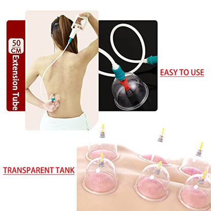 MYMM 12 Cupping Cups Sets Biomagnetic Traditional Professional Chinese Therapy Massage MYMMBuy Supplements Australia