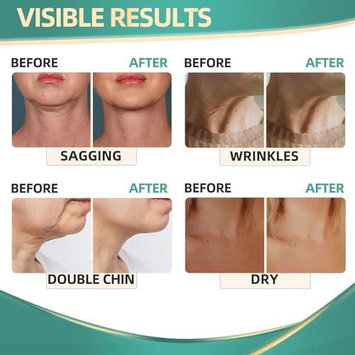 Neck Cream for Tightening Firming: Instant Face Lift Cream - Wrinkle Cream for Women RONKIEBuy Supplements Australia