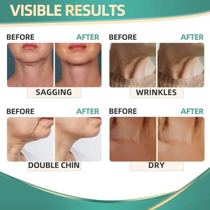 Neck Cream for Tightening Firming: Instant Face Lift Cream - Wrinkle Cream for Women RONKIEBuy Supplements Australia