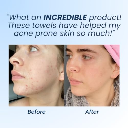 Clean Skin Club Clean Towels XL, Dermatologist Approved, 100% USDA CLEAN SKIN CLUBBuy Supplements Australia