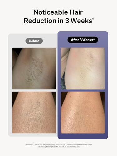 Ulike Laser Hair Removal for Women and Men, Air 3 IPL Hair Removal with Sapphire Ice-Cooling System UlikeBuy Supplements Australia