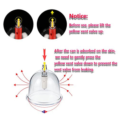 MYMM 12 Cupping Cups Sets Biomagnetic Traditional Professional Chinese Therapy Massage MYMMBuy Supplements Australia