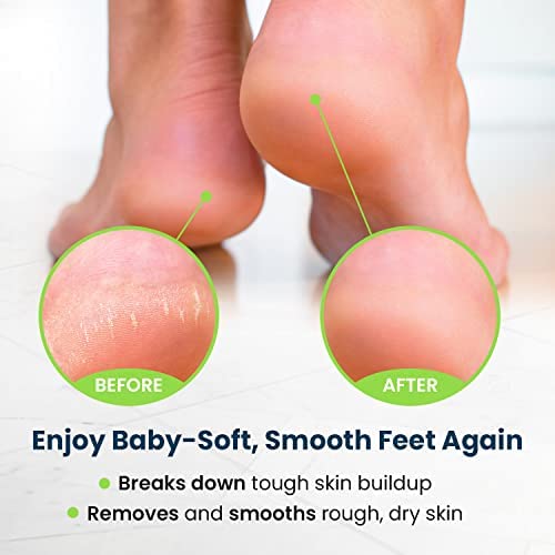 Toenail Fungus Treatment Extra Strength - Advance nail fungus treatment for fingernails FOOT CUREBuy Supplements Australia