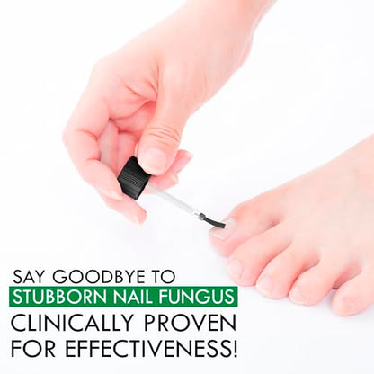 Viking Revolution Toenail Fungus Treatment Extra Strength with 1% Tolnaftate OTC Viking RevolutionBuy Supplements Australia
