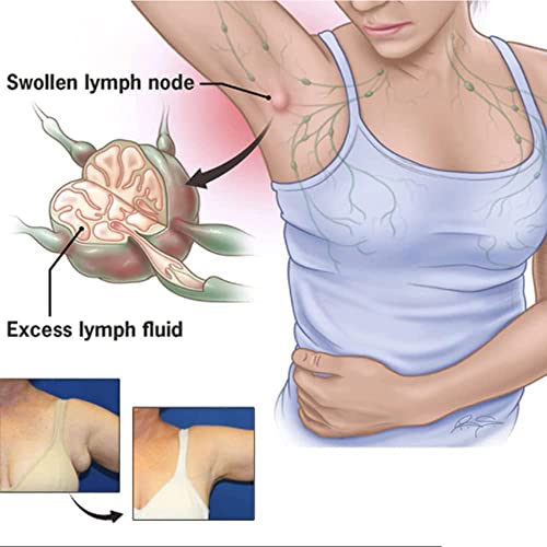 CSIYANJRY99 Lymph Purifying Ring Lymphatic Drainage Therapeutic Rings Set CSIYANJRY99Buy Supplements Australia