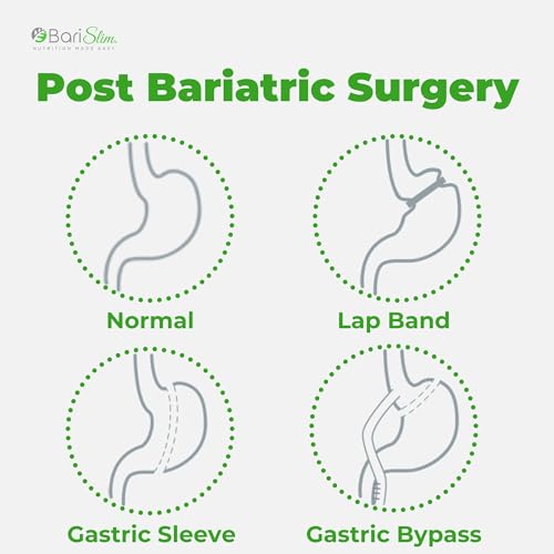 BariSlim Iron Plus Capsules - Formulated for Patients After Weight Loss Surgery Including BariSlimBuy Supplements Australia