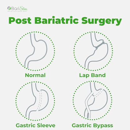 BariSlim Iron Plus Capsules - Formulated for Patients After Weight Loss Surgery Including BariSlimBuy Supplements Australia