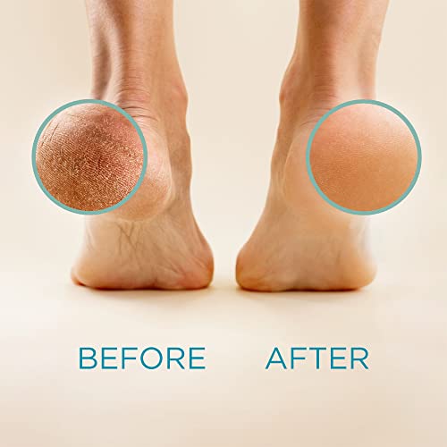 Lee Beauty Professional Callus Remover for Feet - 8 Oz, Original, Powerful Lee Beauty ProfessionalBuy Supplements Australia