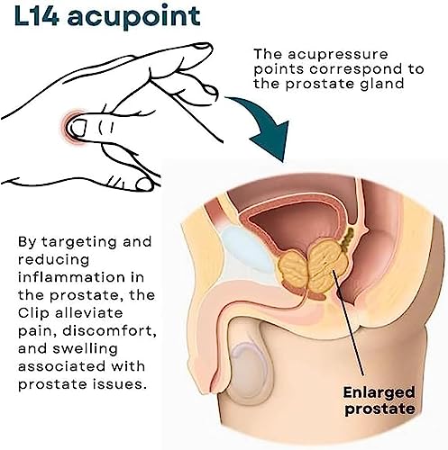 XEYOW Prostate Care Point Clip for Men, Acupressure Hand Pressure Point Clip, Relieve Prostate XEYOWBuy Supplements Australia