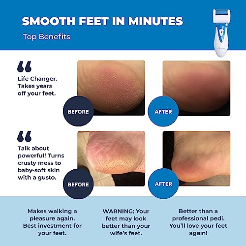 Electric Callus Remover: Own Harmony Professional Pedicure Tools Foot Own HarmonyBuy Supplements Australia