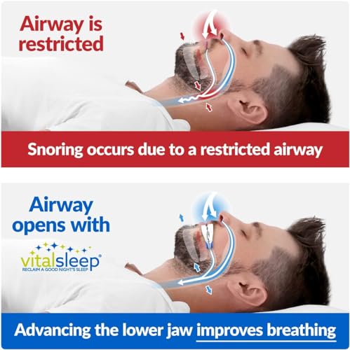 VitalSleep Anti-Snoring Mouthpiece, Adjustable Jaw Positioning Vital SleepBuy Supplements Australia