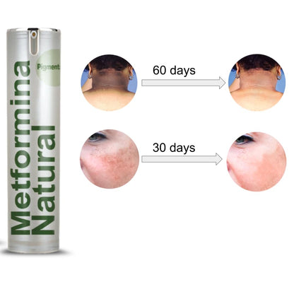 Ni una dieta más METFORMINA NATURAL - Cream for Dark Spots on Face and Body Ni una dieta másBuy Supplements Australia
