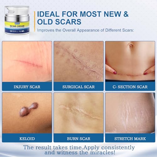 BORMSI Scar Cream,Active Silicone Dimethicone Scar Gel-Advanced BORMSIBuy Supplements Australia