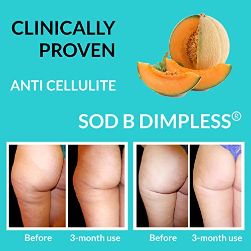 UpNourish Anti Cellulite Supplements - Varicose Veins Support, Restless Leg Relief UpNourishBuy Supplements Australia