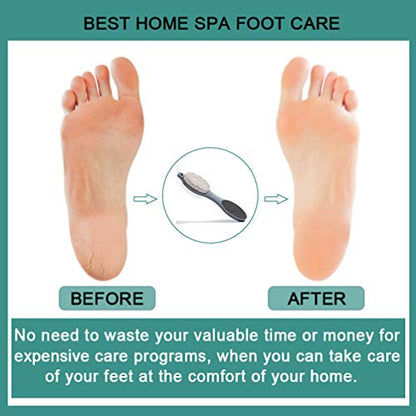 CAREHOOD Foot File Callus Remover - Multi Purpose 4 in 1 Feet Pedicure CAREHOODBuy Supplements Australia