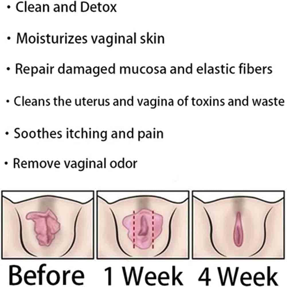Natural Repair Vagianal Capsules, Anniecare Instant Anti-Itch Detox Slimming Products GDSAFSBuy Supplements Australia