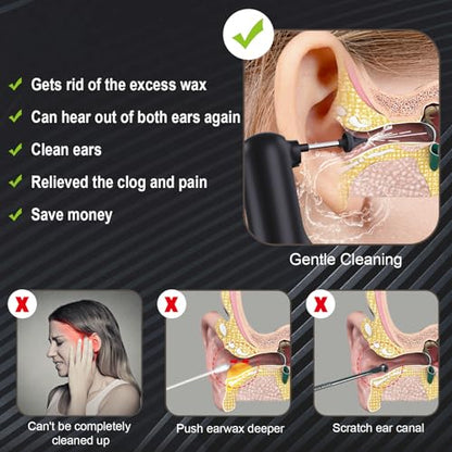 Upgraded Ear Wax Removal,Water Powered Ear Cleaner,Ear Cleaning Kit AlledgeBuy Supplements Australia
