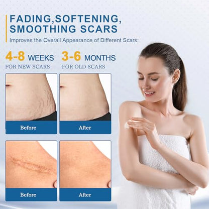 BORMSI Scar Cream,Active Silicone Dimethicone Scar Gel-Advanced BORMSIBuy Supplements Australia