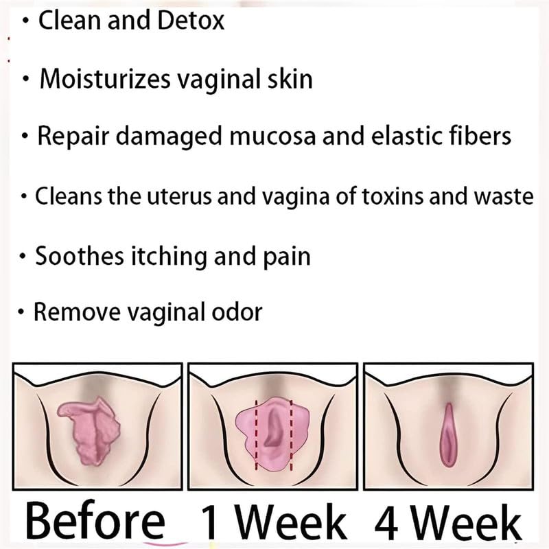 tsoneoo Dexcara Detox Repair - Natural Repair Vagianal Capsules, Natural Repair Vajinal Capsules tsoneooBuy Supplements Australia