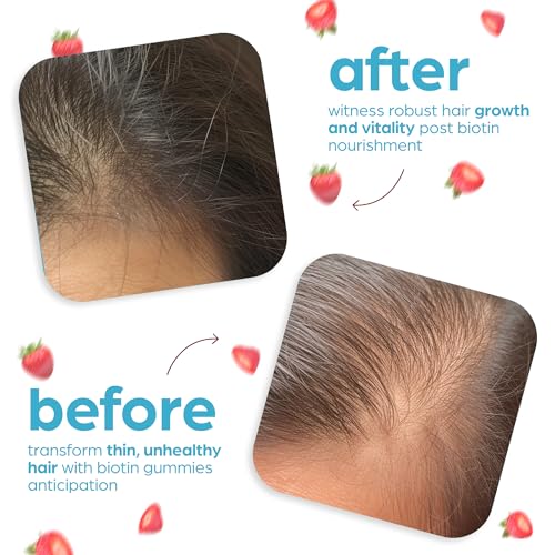 Artnaturals Biotin Gummies for Hair Growth - (100 Gummies - 10000mcg) - Natural Strawberry ArtnaturalsBuy Supplements Australia