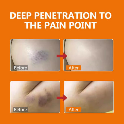 DERMFREE Pain Relief Cream DERMFREEBuy Supplements Australia