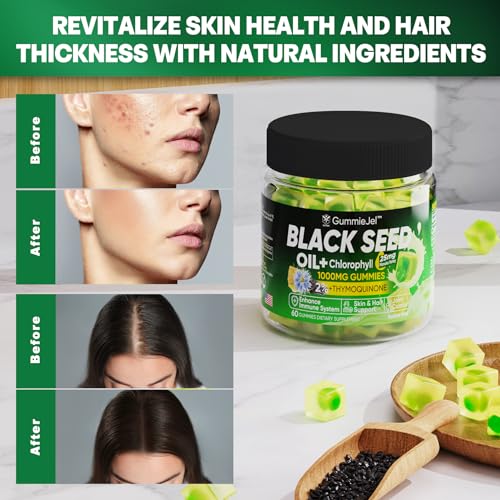 Sugar Free Black Seed Oil Filled Gummies & Chlorophyll, with Hydrolyzed Collagen EnvyCureBuy Supplements Australia