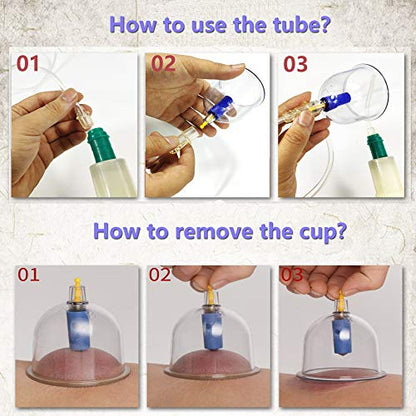 MYMM 12 Cupping Cups Sets Biomagnetic Traditional Professional Chinese Therapy Massage MYMMBuy Supplements Australia