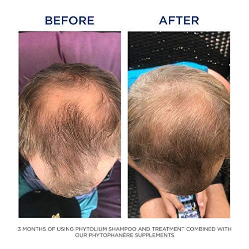PHYTO Phytophanère 100% Natural Hair Loss Thinning Dietary Supplement PHYTOBuy Supplements Australia