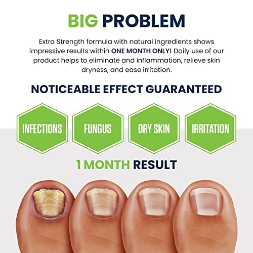Toenail Fungus Treatment Extra Strength - Advance nail fungus treatment for fingernails FOOT CUREBuy Supplements Australia