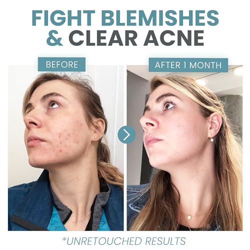 Eva Naturals Vitamin C Face Serum With Hyaluronic Acid - Anti Aging Serum Eva NaturalsBuy Supplements Australia