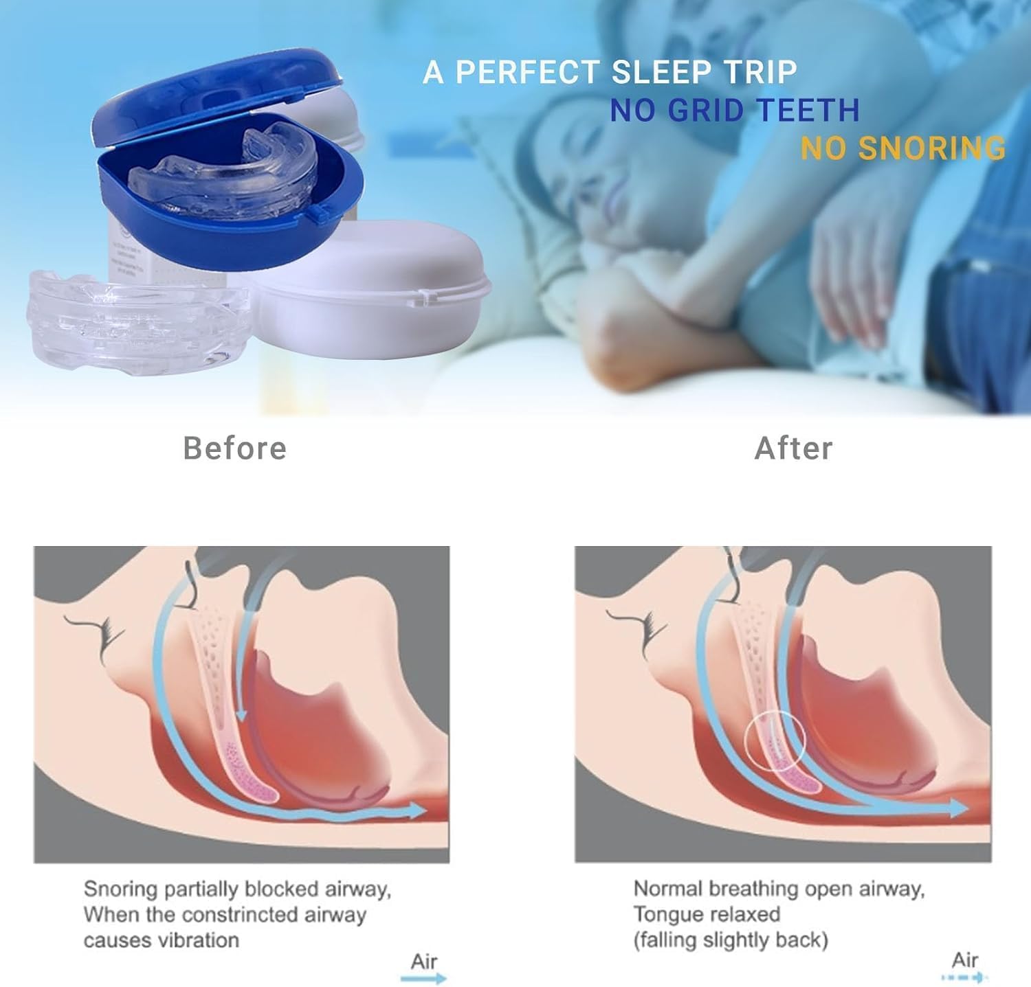 SereneSleep Mouthpiece (Blue) BAWOTYBuy Supplements Australia