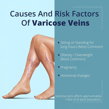 Cream Ayurvedic Solution for Management of Varicose Veins, Spider Veins, Varicocele Helps Reach The Root Cause of varicose Veins Reduces Cramps, Itching & Swelling. Single Tube (25 GMS). GenericBuy Supplements Australia