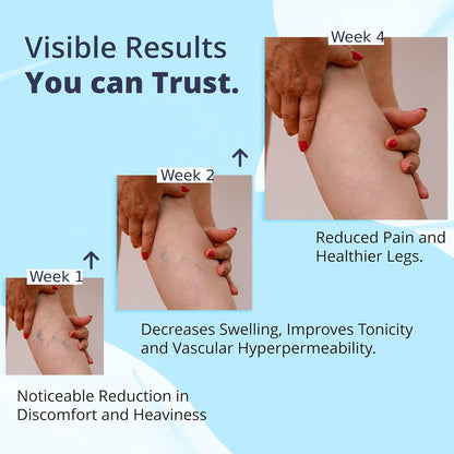 Cream Ayurvedic Solution for Management of Varicose Veins, Spider Veins, Varicocele Helps Reach The Root Cause of varicose Veins Reduces Cramps, Itching & Swelling. Single Tube (25 GMS). GenericBuy Supplements Australia