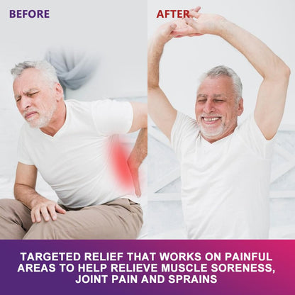 MOSYFEIBI Hyperosteogeny Pain Relief Cream - Natural Herbal Soothing Cream for Joint, Back, Neck & Knee Discomfort, Gentle Topical Massage Cream for Targeted Comfort (2 Boxes) MOSYFEIBIBuy Supplements Australia