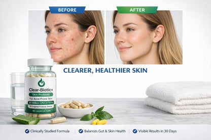 Acne Pills Probiotic Acne Supplements for Teens & Adults - Hormonal Acne Vitamins, Gut Health for Clear Skin, Non-GMO (60 Capsules) Gut Skin Axis Clear-BioticBuy Supplements Australia