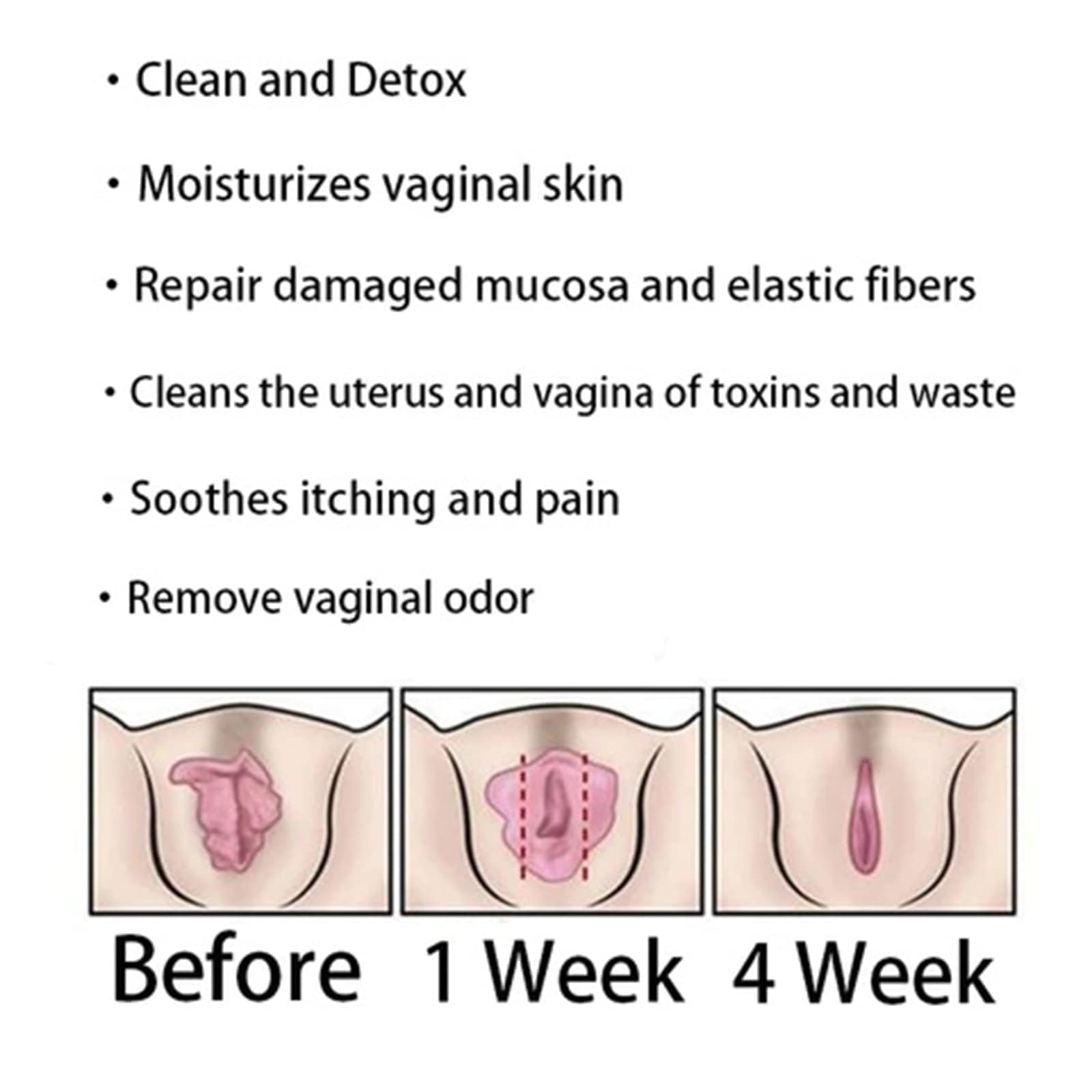 Dexcara - Dexcara Capsules, Dexcara Pills, Dexcara Natural, Dexcara Vaginal Tightening KonenbraBuy Supplements Australia