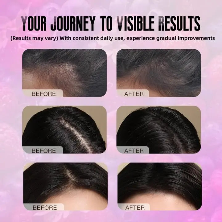BDQBDQ Lumin Hair Growth Gummies, Infused with Biotin, Vitamins, and Botanical Extracts to Support Healthy Hair Growth and Strength BDQBDQBuy Supplements Australia