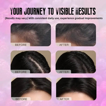 BDQBDQ Lumin Hair Growth Gummies, Infused with Biotin, Vitamins, and Botanical Extracts to Support Healthy Hair Growth and Strength BDQBDQBuy Supplements Australia