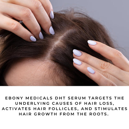Ebony Medicals DHT Blocker Hair Growth Serum - Hair Loss Supplement, Supports Natural Regrowth Natural CurvesBuy Supplements Australia