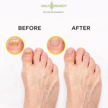Citrus Detox Foot Soak with Epsom Salt - for Foot Callus, Immune Boost, Damaged Toenail DAILY REMEDYBuy Supplements Australia