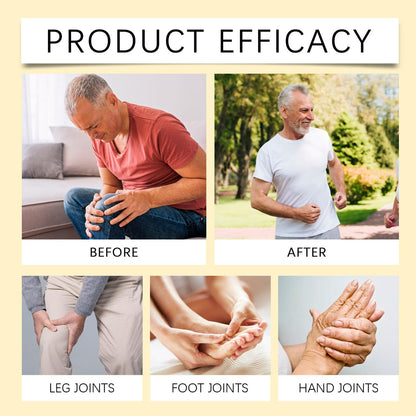 Bee Venom Joint Cream, Natural Bee Venom Skin Cream, Bee Venom Advanced Joint & Bone Cream, Suitable for Everyday Back, Waist, Neck, Hands, Knees, Light Non-Sticky for Men Women Aldult - 2.11 Oz/60g JoanofArcBuy Supplements Australia