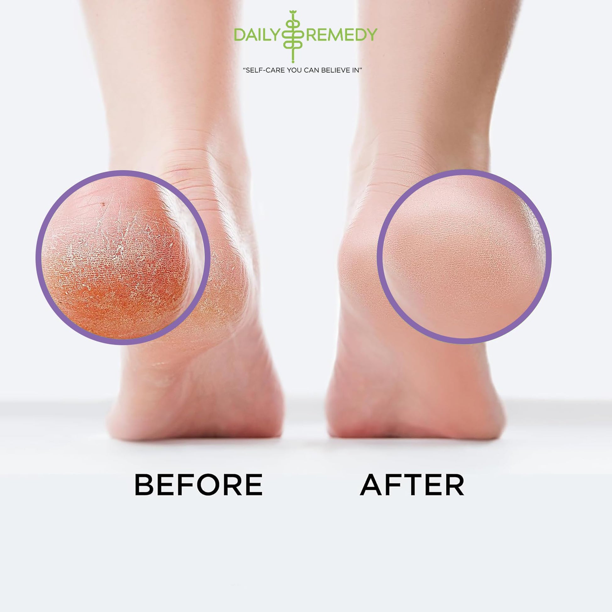Calming Lavender Foot Soak with Epsom Salt, Made in USA, Foot Soak Soothes Sore Tired DAILY REMEDYBuy Supplements Australia