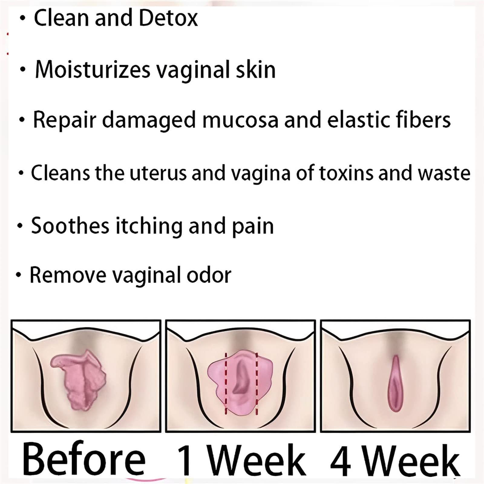AnnieCare Instant Anti-Itch Detox Slimming Products, Annie Care Natural Detox Viginal Gel DASHENRANBuy Supplements Australia