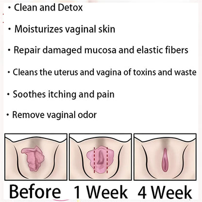AnnieCare Instant Anti-Itch Detox Slimming Products, Annie Care Natural Detox Viginal Gel DASHENRANBuy Supplements Australia