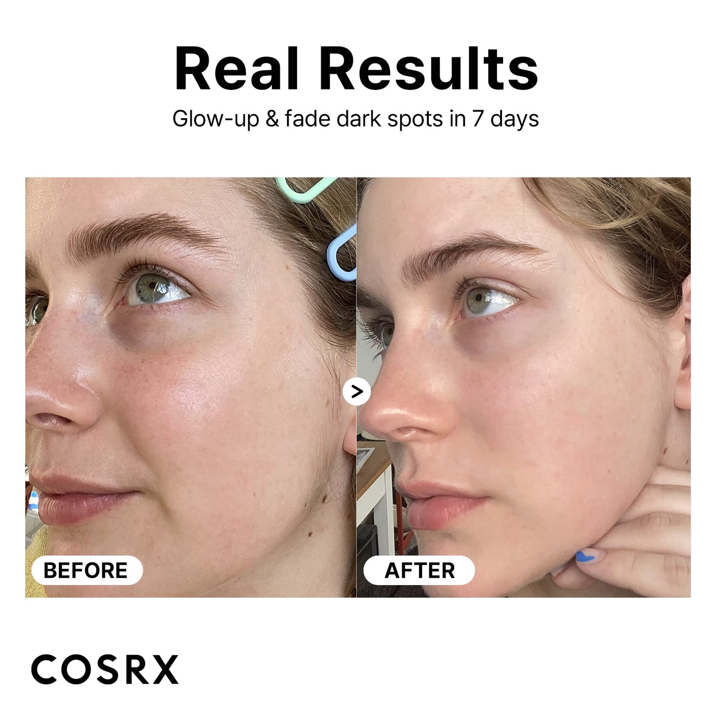 COSRX Pure Vitamin C Serum with Vitamin E & Hyaluronic Acid, Brightening COSRXBuy Supplements Australia