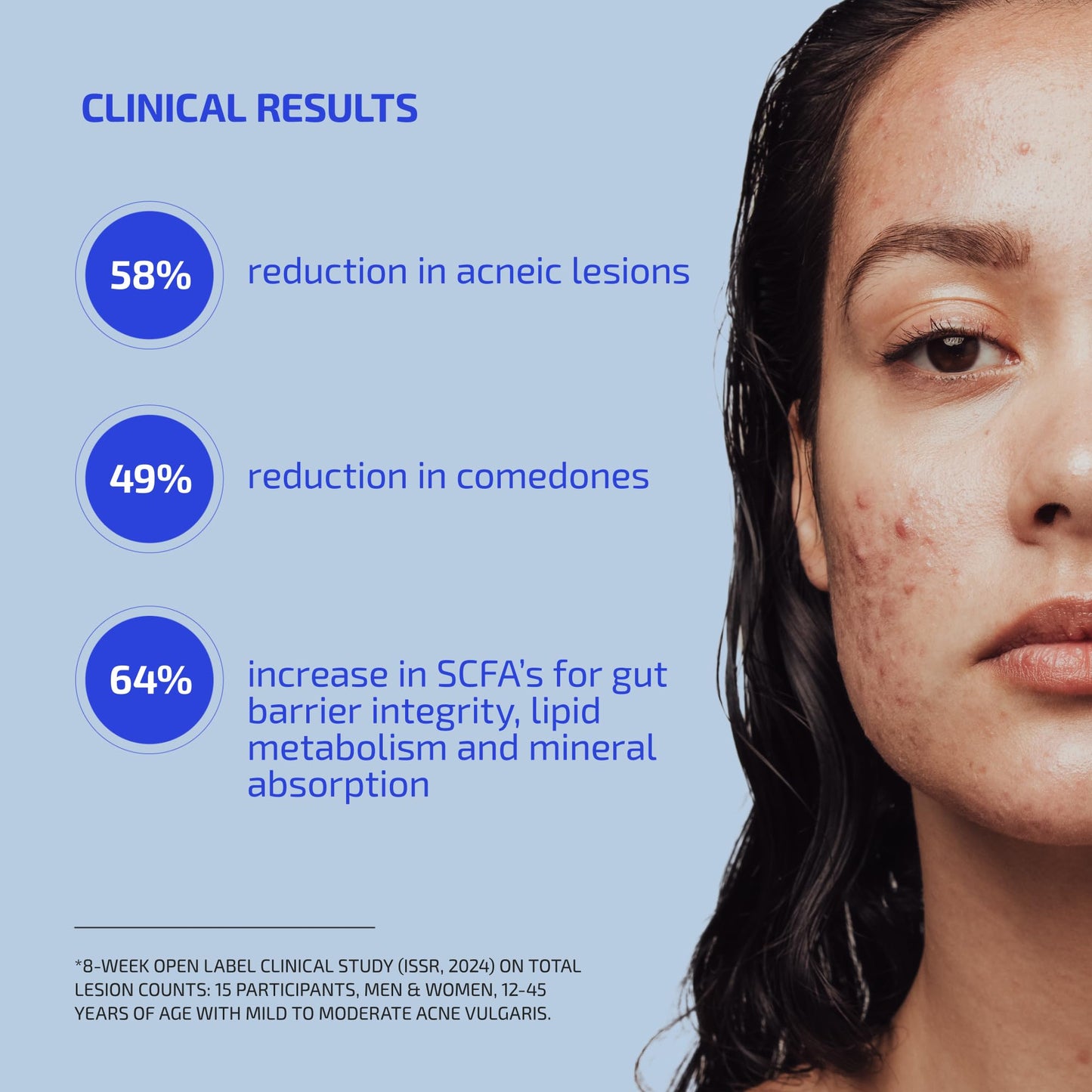 Codex Labs Shaant Clear Skin Supplement – 60 Vegan Capsules | Acne Probiotics with 9-Strain Blend, Green Tea EGCG & Guggul – Daily Support for Acne-Prone Skin & Clear Complexion Codex LabsBuy Supplements Australia