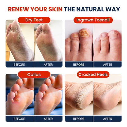 Muscle Relief Foot Soak with Epsom Salts - All Natural Salts for Post Workout Recovery FOOT CUREBuy Supplements Australia