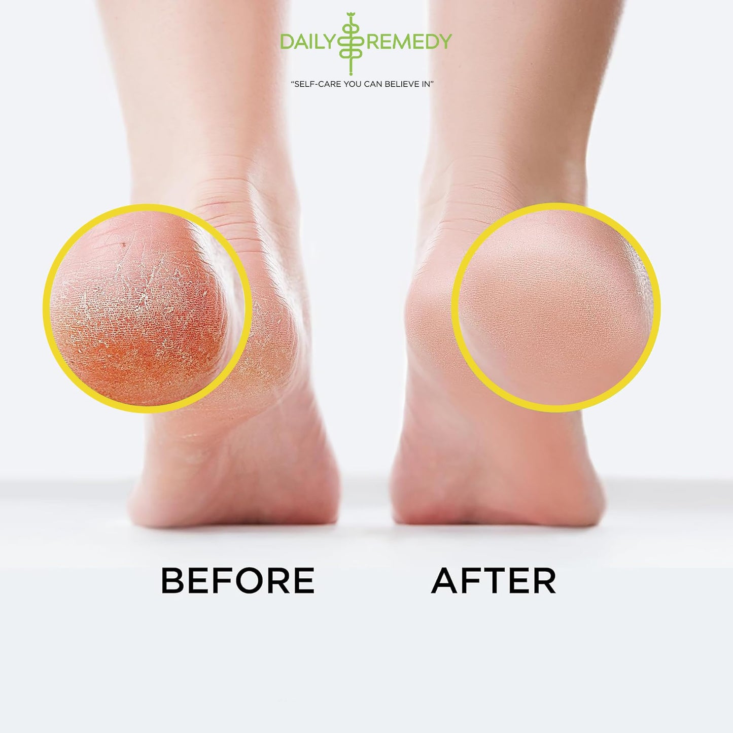 Citrus Detox Foot Soak with Epsom Salt - for Foot Callus, Immune Boost, Damaged Toenail DAILY REMEDYBuy Supplements Australia